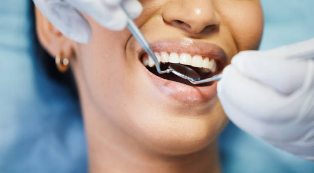 Best Emergency Tooth Extraction in Nellieburg, MS