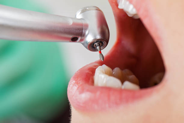 Best Emergency TMJ Treatment in Nellieburg, MS